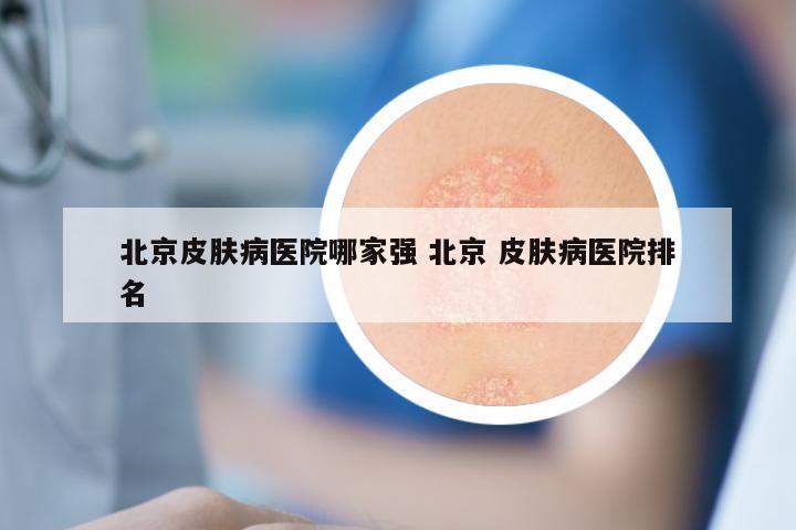 皮肤病医院北京哪家好？——全面解析与选择指南