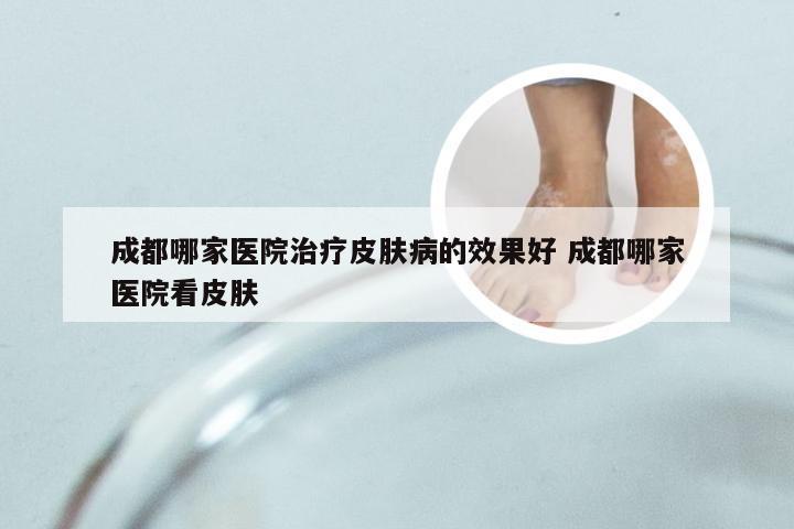 成都皮肤科医院哪家好？—— 深度解析与患者指南