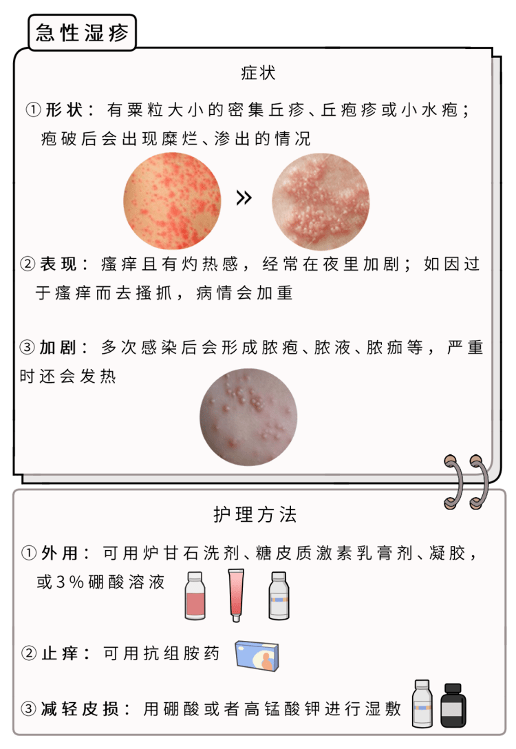 皮肤湿疹的药物治疗与日常护理指南