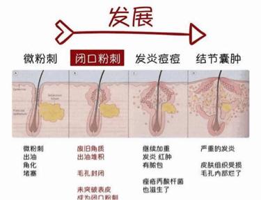 皮肤病图谱大全珍藏版，解锁肌肤健康的秘密