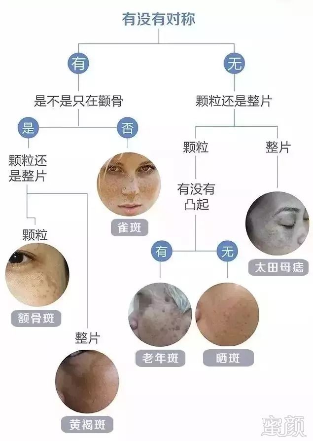 皮肤斑的类型与解析