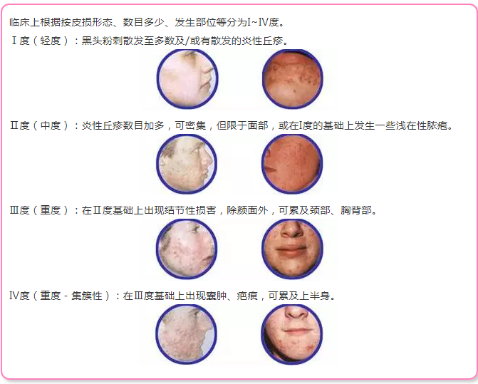 皮肤上的秘密，解读褐色小疙瘩的成因与应对策略