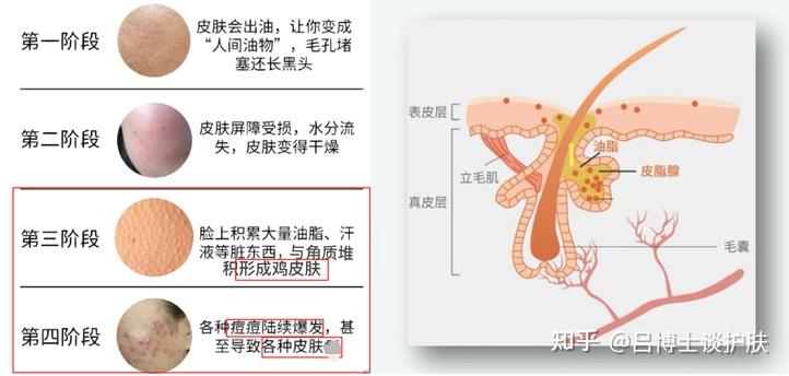 晚上皮肤瘙痒起疙瘩，探寻背后的原因与应对策略