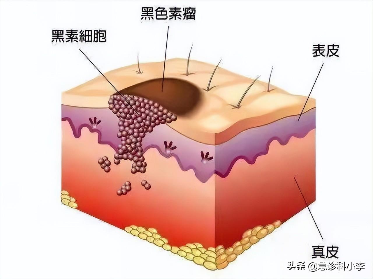 100种常见皮肤病对照表，您的皮肤健康指南