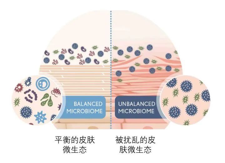 皮肤有痘痘的微观世界，一场肌肤深处的探索之旅