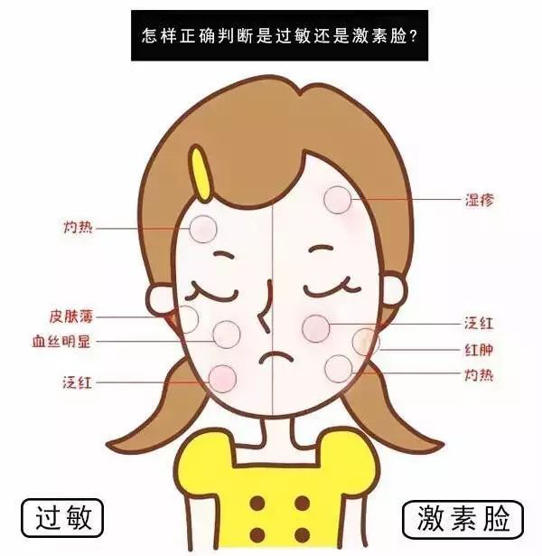 脸部过敏后如何应对皮肤干燥起皮——科学护理指南