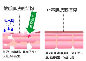 皮肤干燥起癣，科学应对策略与日常护理指南