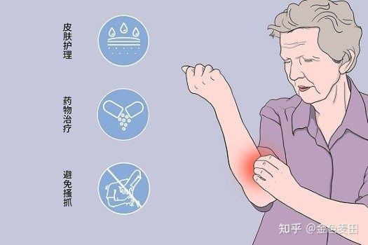 皮肤瘙痒，科学选择药物，缓解不适的智慧指南