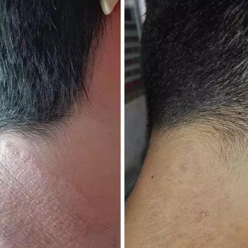 脖子皮肤瘙痒，原因、应对策略与日常护理指南