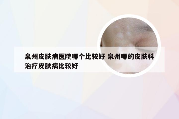 福州皮肤病医院哪家好？—— 深度解析与推荐