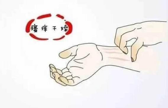 过敏皮肤大面积红痒的应对策略，科学止痒，温和护理