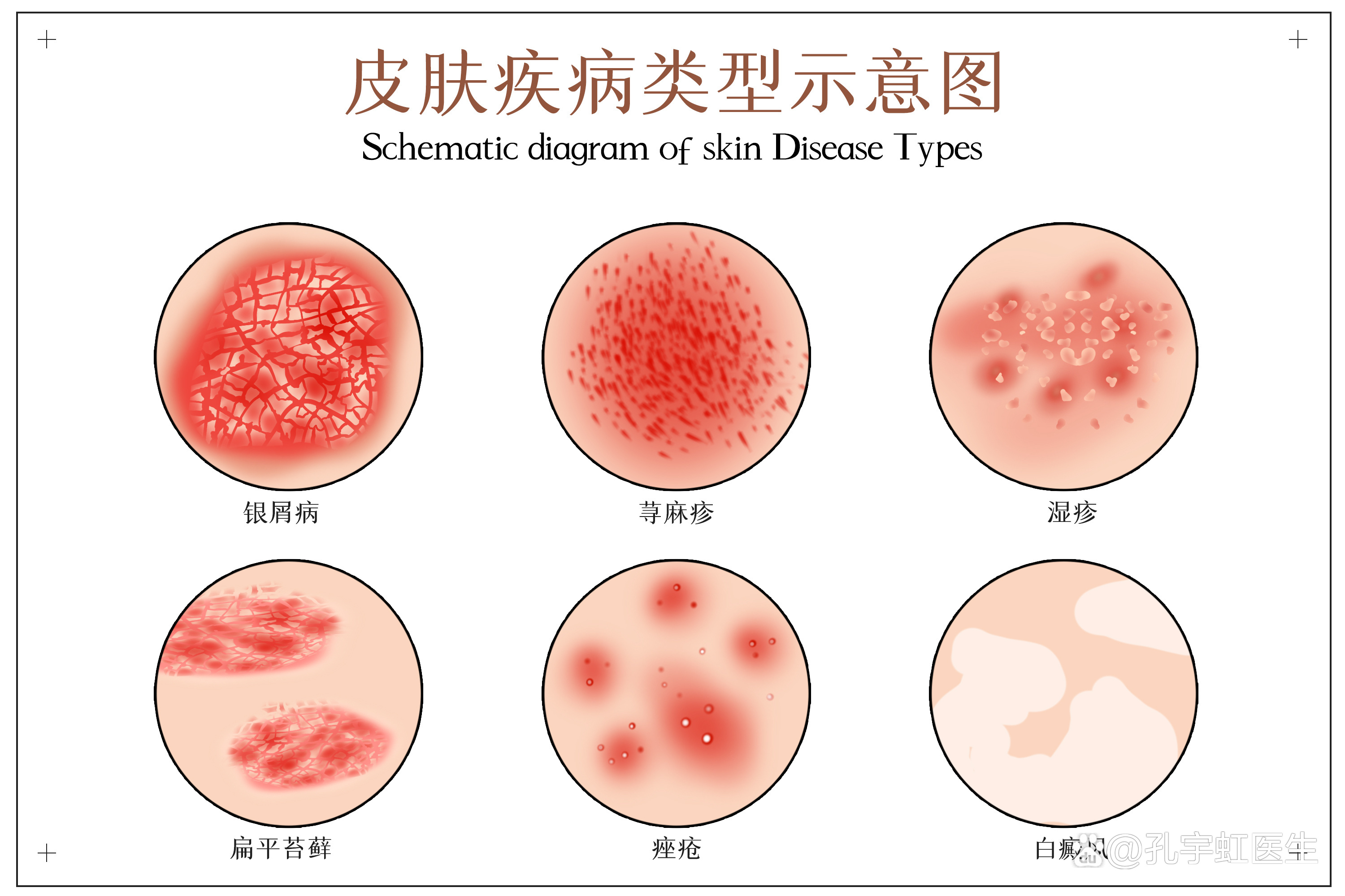 皮肤病种类及其表现详解