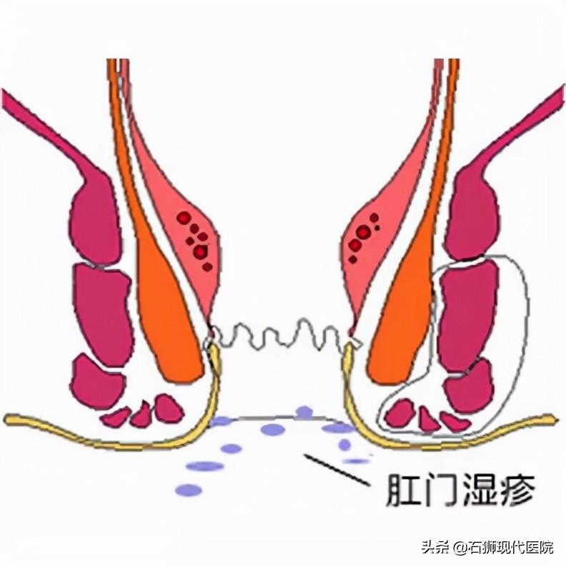 渗出性皮肤病，类型、症状与治疗