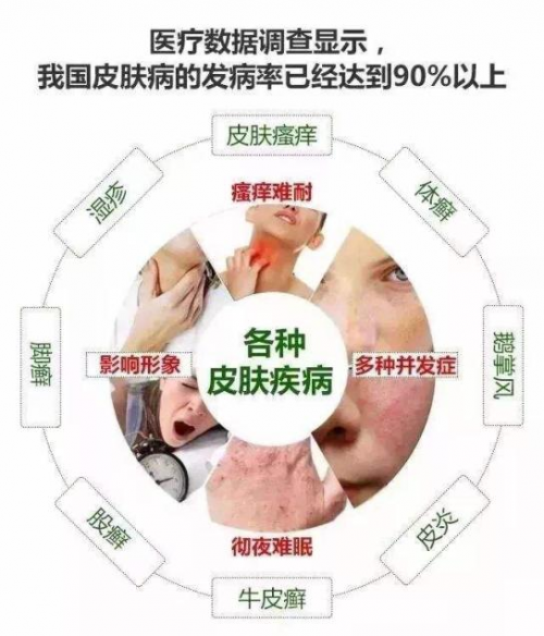 皮肤病中的传染病，认识与预防