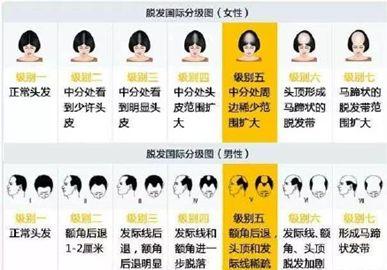 头发稀疏的烦恼与解决之道，饮食与生活的双重策略