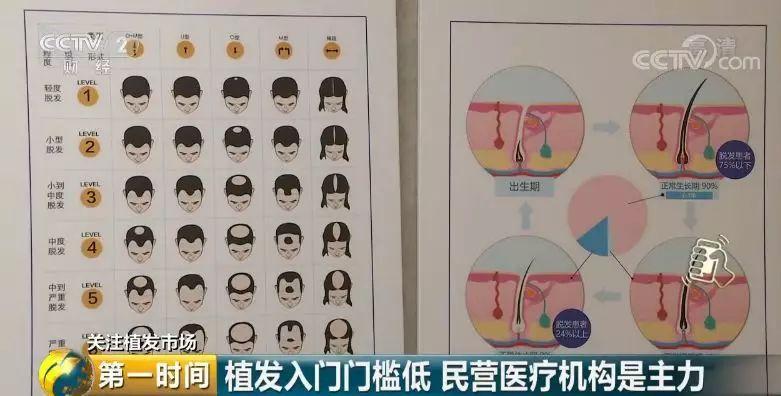 头发突然秃了一块，应挂哪个科室就诊？