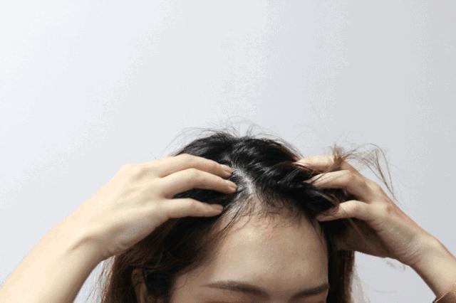 头发变黑，科学探索与自然疗法的双轨并进
