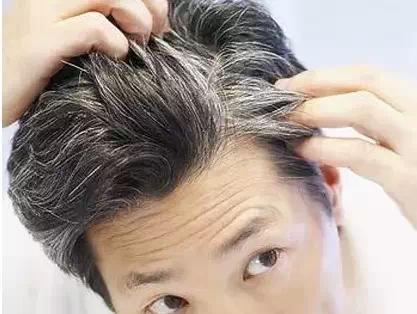 头发变白的原因探析，从生理到心理的全面解析
