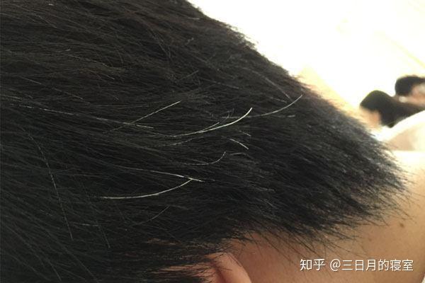 揭秘长白头发的原因及科学调理方法