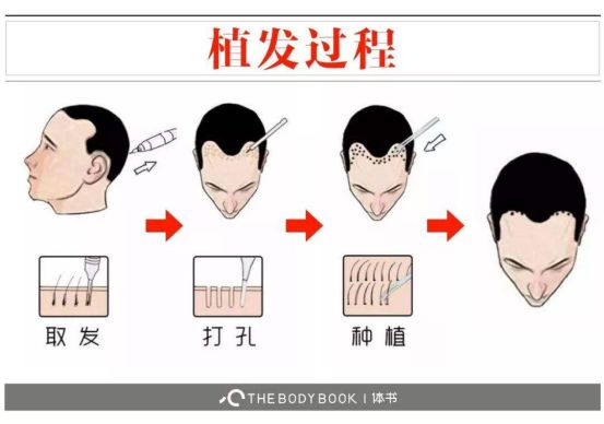 头发油腻的背后，原因、影响与应对策略