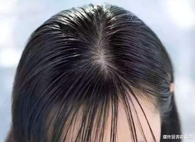 头发冒油，身体状况的隐形信号