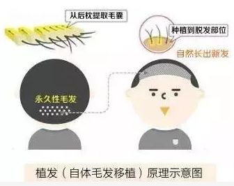 头发掉得严重，该去医院看哪个科？——专业指南与建议