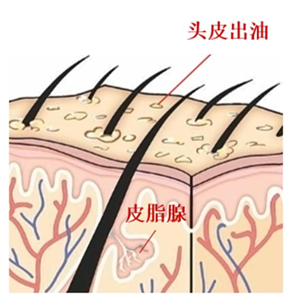 头发出油厉害，探究背后的原因与应对策略