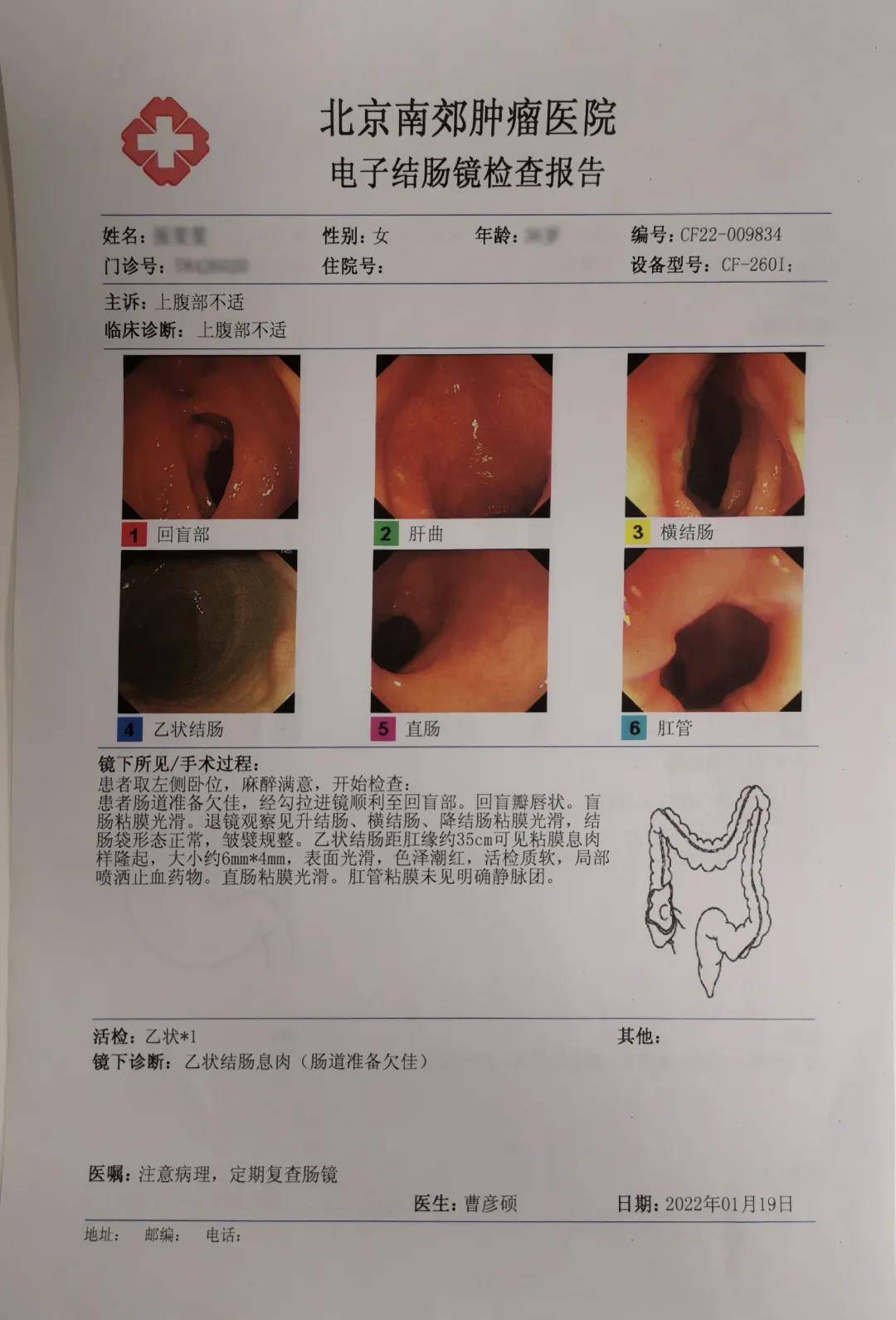 肠胃镜检查全过程，从准备到恢复的全面解析