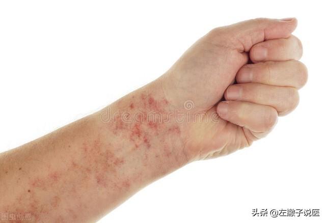 昆明地区治疗腋臭的权威医院选择与指南
