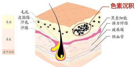 皮肤7个层次结构图，揭秘人体最外层的奥秘