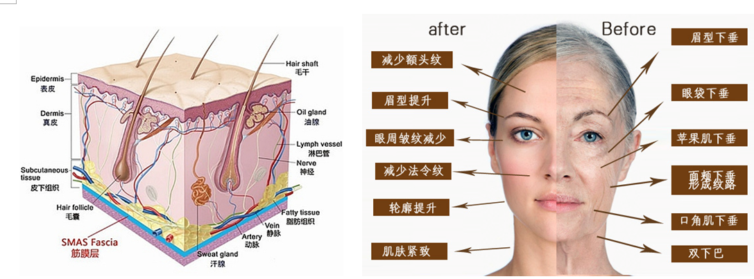 皮肤7个层次结构图与注射美容的奥秘