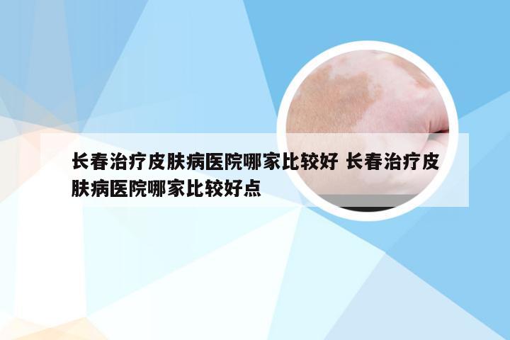 皮肤病诊疗新体验，长春肤康医院官网在线问诊服务解析