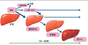 人的肝脏，一个复杂而关键的器官——真实照片解析