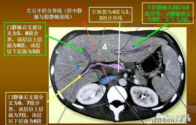 肝脏位置，真实照片与解剖图解的对比解析