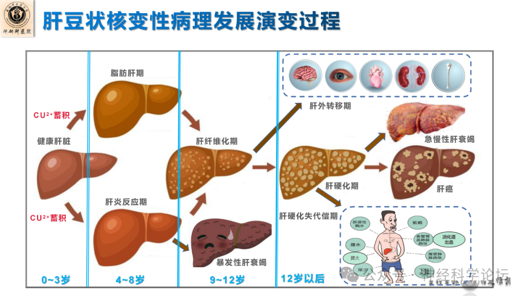 肝脏解剖的精细图谱，探索生命之舟的奥秘