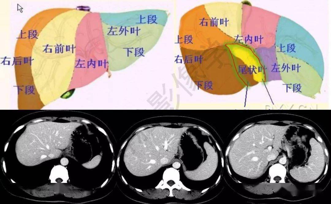 肝脏分叶分段解剖图，深入理解与临床应用