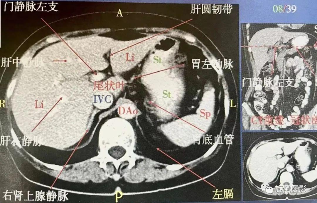 肝脏解剖图手绘，探索人体生命工厂的奥秘