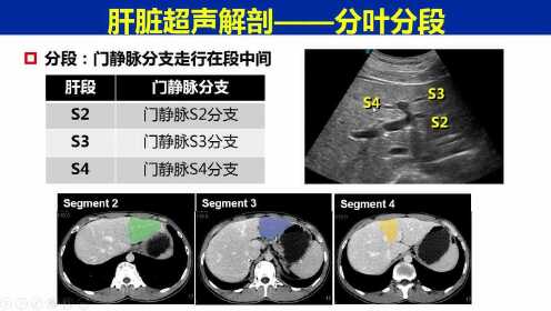 肝脏超声分段解剖图，透视肝脏健康的透视镜