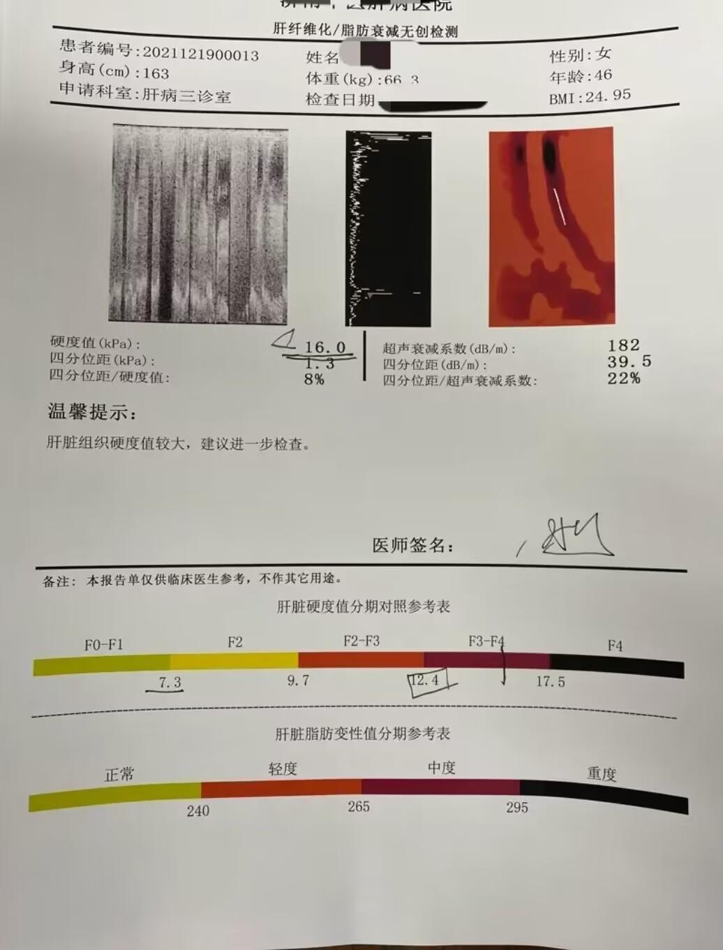 肝脏健康守护，了解肝脏硬度kPa正常值与脂肪衰减的奥秘