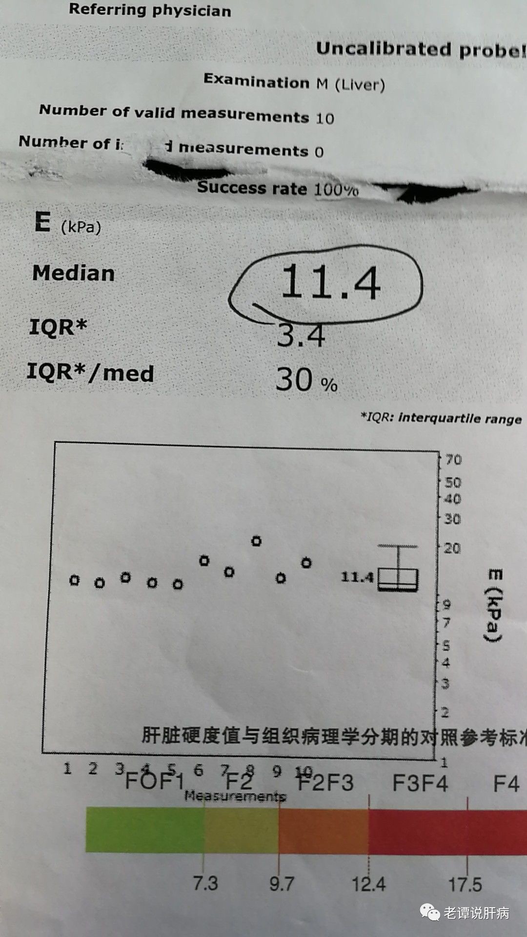 肝脏硬度kPa，解读肝脏健康的隐形密码