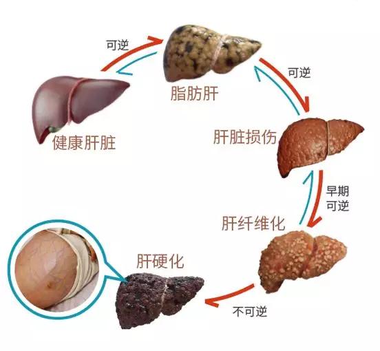 肝脏养护，守护生命之化工厂的秘密