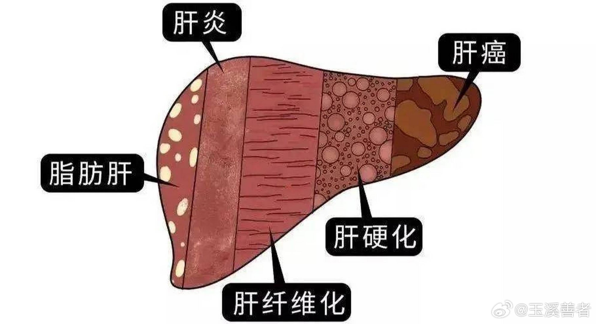 肝脏，人体最大的腺体，超越消化的非凡功能