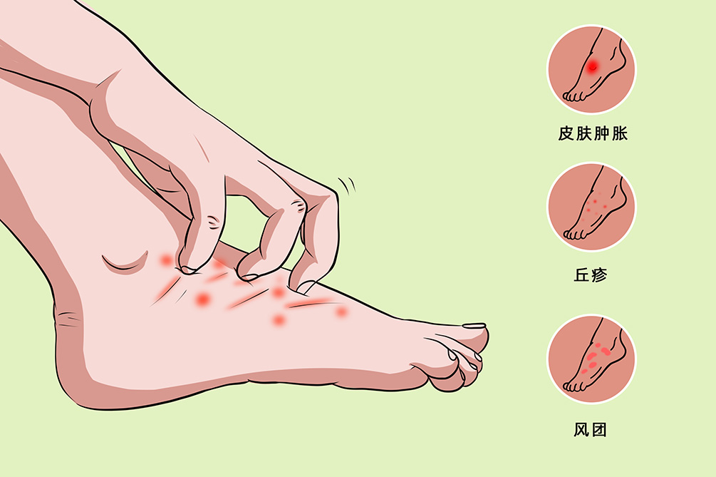 脚杆皮肤发痒，原因、预防与应对策略