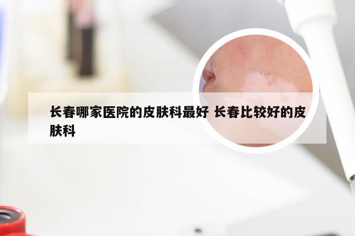 皮肤科医院哪家较好？长春肤康医院实力解析