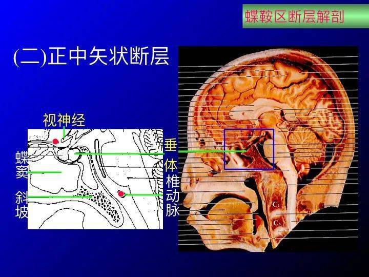 探索肠胃的奥秘，高清图片与解剖图解的深度剖析