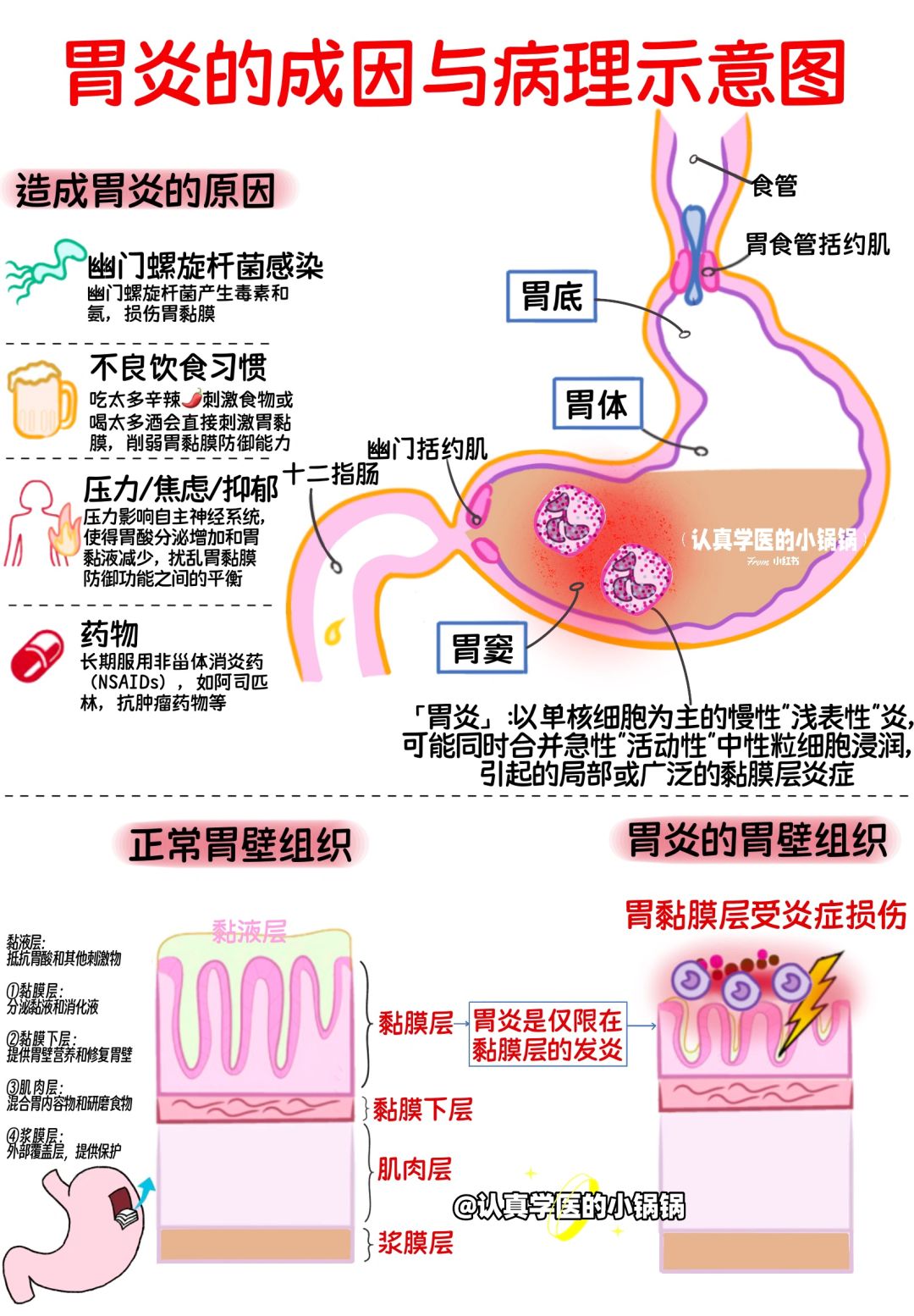 肠胃炎的全面解析与治愈之道