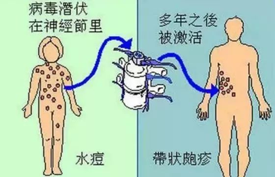 肠胃型感冒，认识症状，科学应对