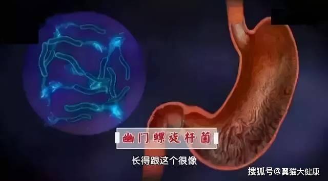 肠胃不消化腹胀，科学用药指南与自然疗法并重