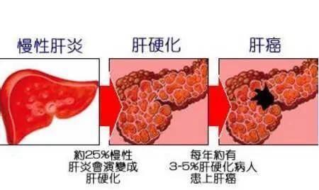 肝脏不好，吃什么才能养肝护肝？