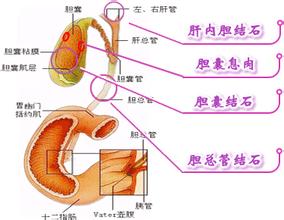 肝脏钙化灶，挂什么科？——全面解析与就医指南